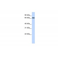 Antibody used in WB on Human HepG2 at 0.2-1 ug/ml.