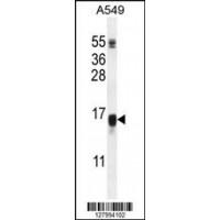 Western blot analysis in A549 cell line lysates (35ug/lane).