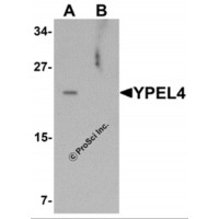 Western blot analysis of YPEL4 in SW480 cell lysate with YPEL4 antibody at 1 μg/mL in (A) the absence and (B) the presence of blocking peptide.