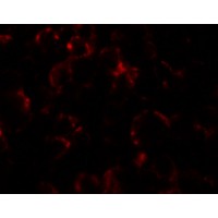 Immunofluorescence of YPEL4 in SW480 cells with YPEL4 antibody at 5 μg/ml.