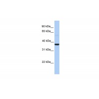Antibody used in WB on Human Lung at 0.2-1 ug/ml.
