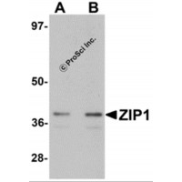 Western blot analysis of ZIP1 in mouse kidney tissue lysate with ZIP1 antibody at (A) 1 and (B) 2 μg/mL.