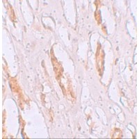 Immunohistochemistry of ZIP1 in human kidney tissue with ZIP1 antibody at 2.5 μg/mL.