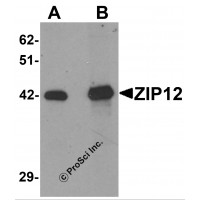 Western blot analysis of ZIP12 in HepG2 cell lysate with ZIP12 antibody at (A) 0.5 and (B) 1 μg/mL.