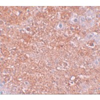 Immunohistochemistry of ZIP12 in mouse liver tissue with ZIP12 antibody at 2.5 μg/mL.