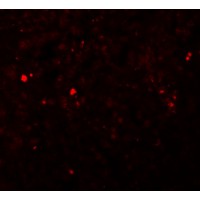 Immunofluorescence of ZIP13 in human spleen tissue with ZIP13 antibody at 20 μg/mL.