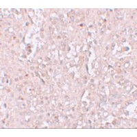 Immunohistochemistry of ZIP13 in human spleen tissue with ZIP13 antibody at 2.5 μg/mL.