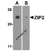 Western blot analysis of ZIP2 in (A) mouse and (B) rat brain tissue lysate with ZIP2 antibody at 1 μg/mL.