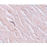 Immunohistochemistry of ZIP2 in human brain tissue with ZIP2 antibody at 2.5 μg/mL.