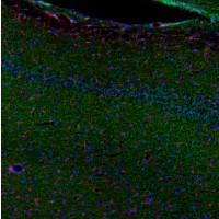 This antibody stained colchicine injected rat brain (hippocampus CA1 region) tissue. The primary antibody was incubated at 1.0 ug/ml overnight at 4˚C. This was followed by a peroxidase conjugated secondary antibody and then a fluorescein Tyramide Signal Amplification (TSA) reagent. Optimal concentrations and conditions may vary.