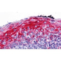 Immunohistochemistry of ZMYM4 in human tonsil with ZMYM4 antibody at 5 μg/mL.