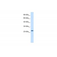 Antibody used in WB on Human Jurkat cells at 1.25 ug/ml.