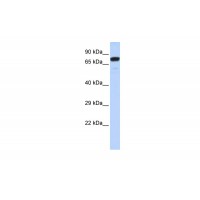 Antibody used in WB on Human HeLa at 0.2-1 ug/ml.
