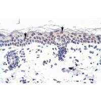 Antibody used in IHC on Human Skin.