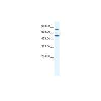 Antibody used in WB on Human Jurkat 0.2-1 ug/ml.