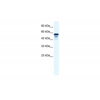 Antibody used in WB on Human Jurkat 0.2-1 ug/ml.