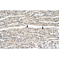 Antibody used in IHC on Human Heart.