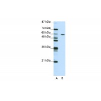 Antibody used in WB on Human Jurkat 1.25 ug/ml.