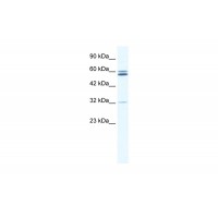 Antibody used in WB on Human Jurkat 0.125 ug/ml.