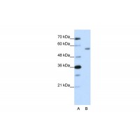 Antibody used in WB on Human HepG2 at 1.25 ug/ml.