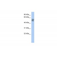 Antibody used in WB on Human HT1080 at 0.2-1 ug/ml.