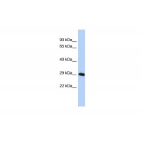 Antibody used in WB on Human MCF-7 at 0.2-1 ug/ml.