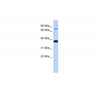 Antibody used in WB on Human MCF-7 at 0.2-1 ug/ml.