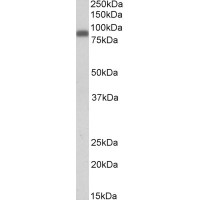 Western Blot (0.1μg/ml) staining of Peripheral Blood Mononucleocytes lysate (35μg protein in RIPA buffer). Primary incubation was 1 hour. Detected by chemiluminescence.