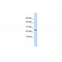 Antibody used in WB on Human Small Intestine at 0.2-1 ug/ml.