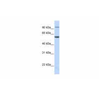 Antibody used in WB on Human MCF-7 at 0.2-1 ug/ml.