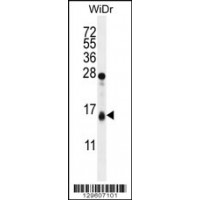 Western blot analysis in WiDr cell line lysates (35ug/lane).