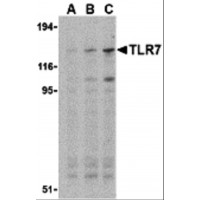 Western blot analysis of TLR7 in Daudi cell lysates with TLR7 antibody at (A) 0.5, (B) 1, and (C) 2 μg/mL.