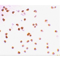 Immunocytochemistry staining of Daudi cells using TLR7 antibody at 2 μg/mL.