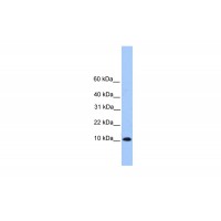 Antibody used in WB on Human HeLa at 0.2-1 ug/ml.