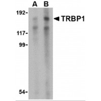 Western blot analysis of TRBP1 in 3T3 cell lysate with TRBP1 antibody at (A) 1 and (B) 2 μg/mL.