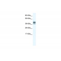 Antibody used in WB on Mouse SP2/0 at 5.0 ug/ml.