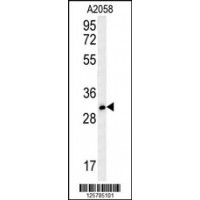 Western blot analysis in A2058 cell line lysates (35ug/lane).