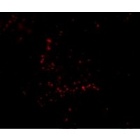 Immunofluorescence of TRIM30 in Human Ovary cells with TRIM30 antibody at 20 μg/mL.