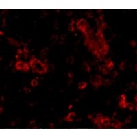 Immunofluorescence of TRIM30 in Human Ovary cells with TRIM30 antibody at 20 μg/mL.