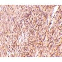 Immunohistochemistry of TRIM30 in mouse ovary tissue with TRIM30 antibody at 10 μg/mL.