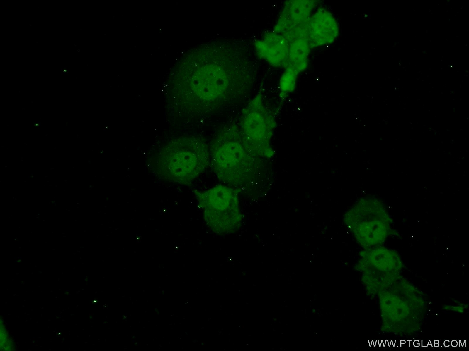 Immunofluorescent analysis of A431 cells using 13621-1-AP( ADAT2 Antibody) at dilution of 1:50 and Alexa Fluor 488-congugated AffiniPure Goat Anti-Rabbit IgG(H+L)