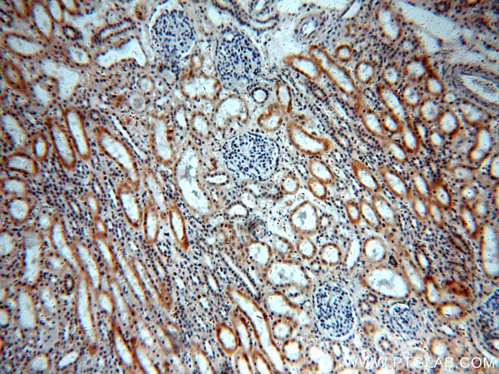 Immunohistochemical of paraffin-embedded human kidney using 20110-1-AP(FLJ10357 antibody) at dilution of 1:50 (under 10x lens)