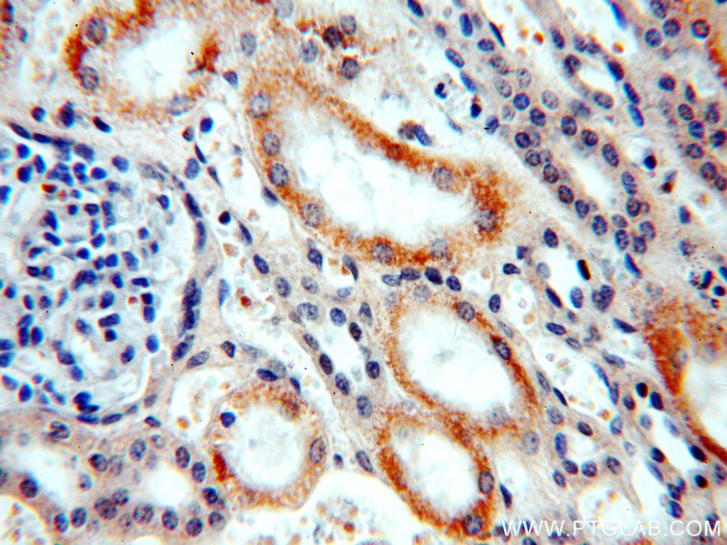 Immunohistochemical of paraffin-embedded human kidney using 20110-1-AP(FLJ10357 antibody) at dilution of 1:50 (under 40x lens)