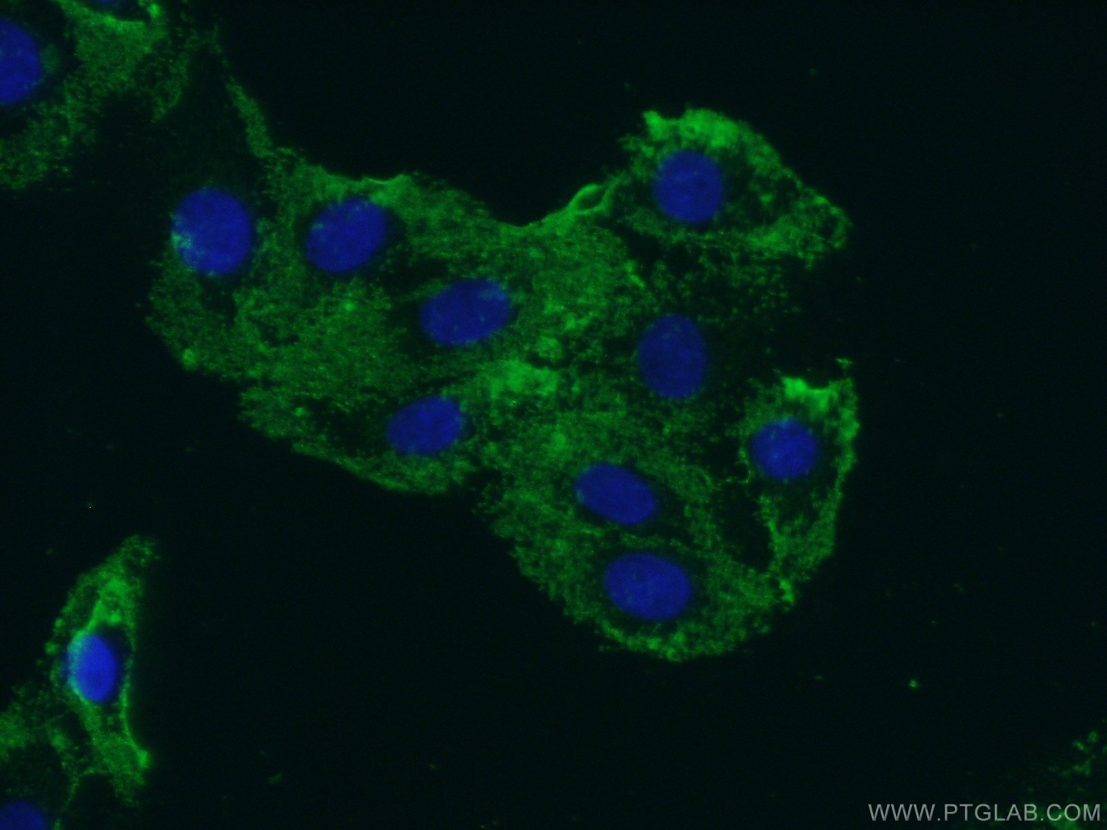 Immunofluorescent analysis of ( -20℃ Acetone ) fixed SH-SY5Y cells using 20110-1-AP( FLJ10357 Antibody) at dilution of 1:50 and Alexa Fluor 488-congugated AffiniPure Goat Anti-Rabbit IgG(H+L)
