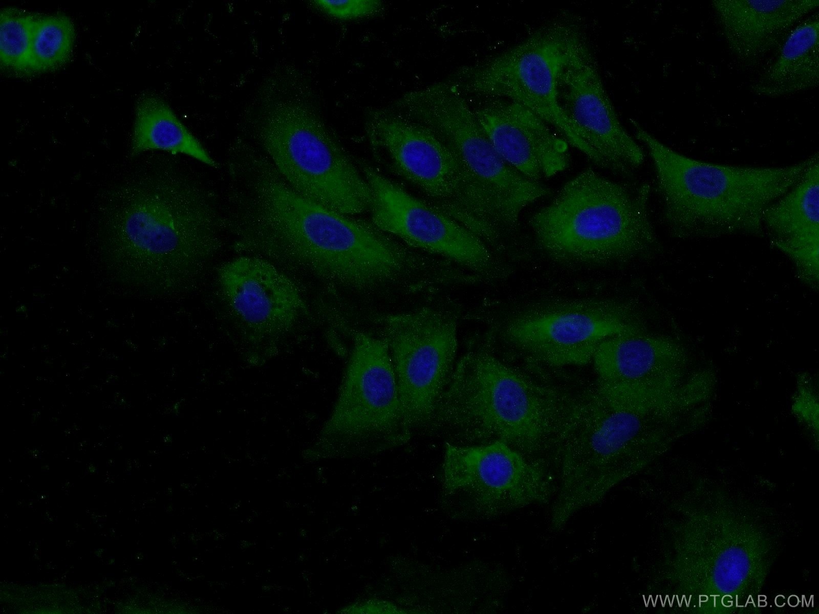 Immunofluorescent analysis of A549 cells using 13461-2-AP( BPIL1 Antibody) at dilution of 1:50 and Alexa Fluor 488-congugated AffiniPure Goat Anti-Rabbit IgG(H+L)