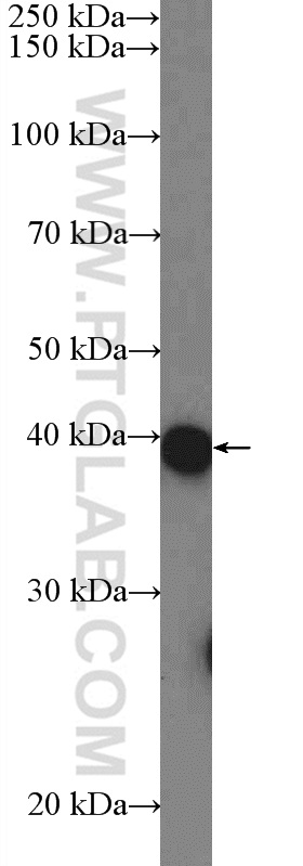 MCF-7 cells were subjected to SDS PAGE followed by western blot with 20919-1-AP( C11orf42 Antibody) at dilution of 1:600