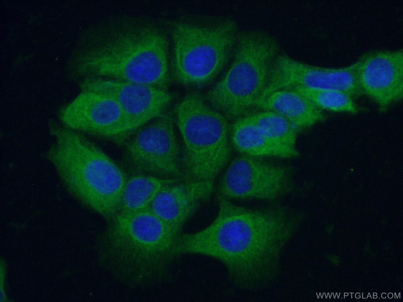 Immunofluorescent analysis of ( -20℃ Ethanol ) fixed MCF-7 cells using 20919-1-AP( C11orf42 Antibody) at dilution of 1:50 and Alexa Fluor 488-congugated AffiniPure Goat Anti-Rabbit IgG(H+L)