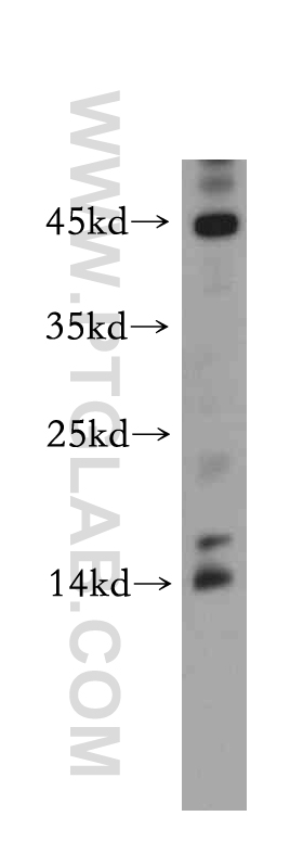 HeLa cells were subjected to SDS PAGE followed by western blot with 20409-1-AP(C11orf51 antibody) at dilution of 1:300