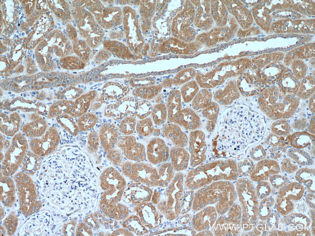 Immunohistochemistry of paraffin-embedded human kidney tissue slide using 25583-1-AP( C13orf30 Antibody) at dilution of 1:200 (under 10x lens).