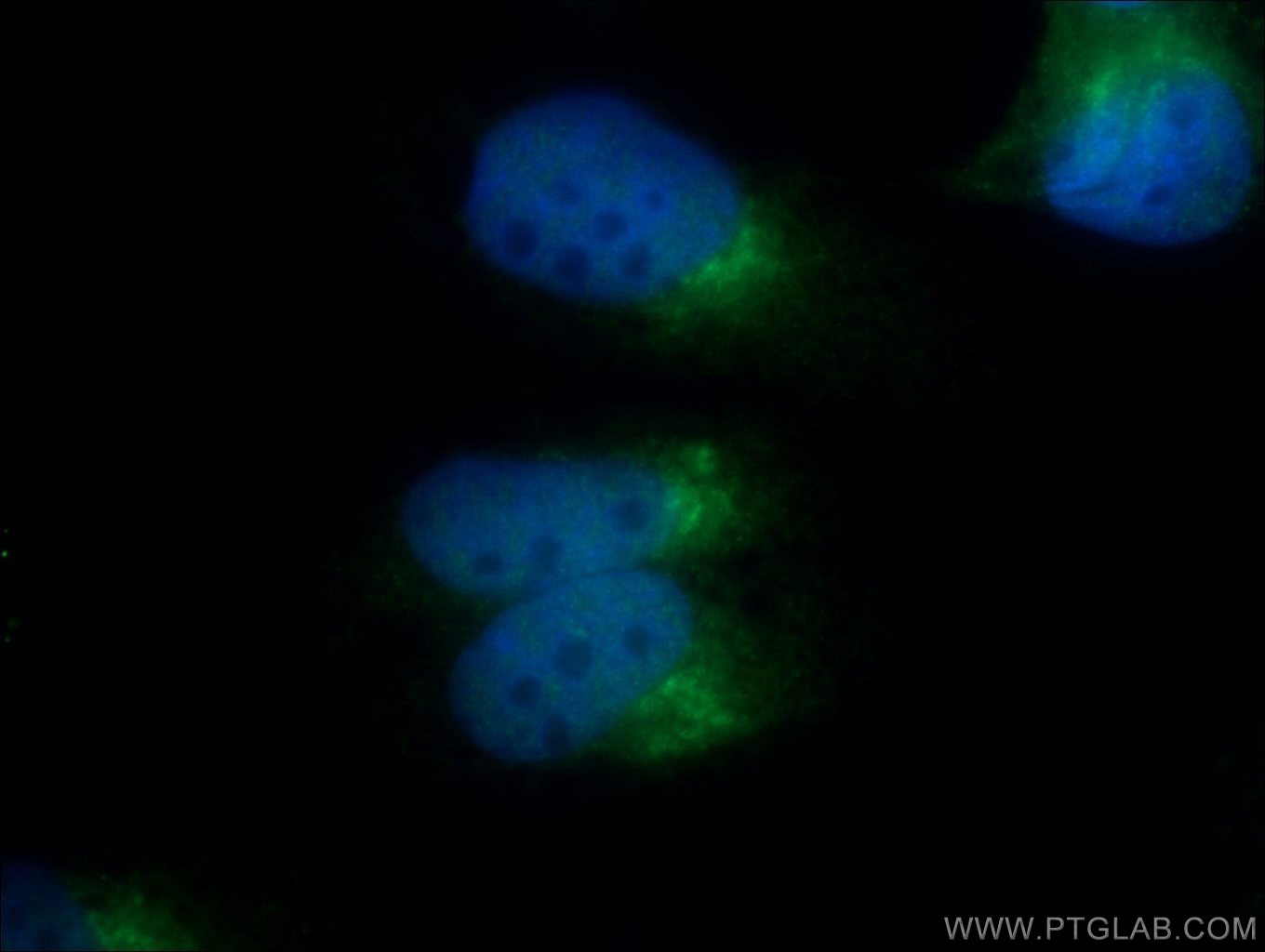 Immunofluorescent analysis of MDCK cells using 25583-1-AP( C13orf30 Antibody) at dilution of 1:25 and Alexa Fluor 488-congugated AffiniPure Goat Anti-Rabbit IgG(H+L)